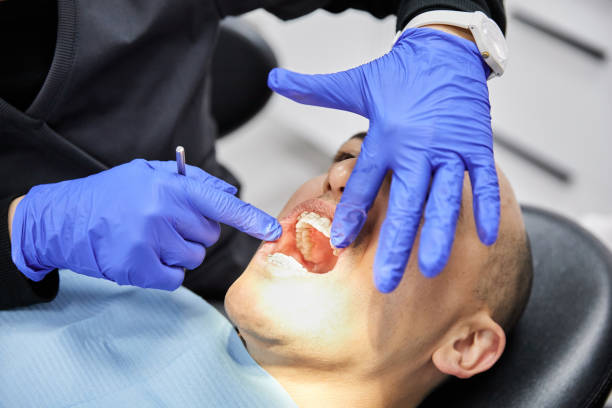 Best Emergency Wisdom Teeth Removal in East Harwich, MA